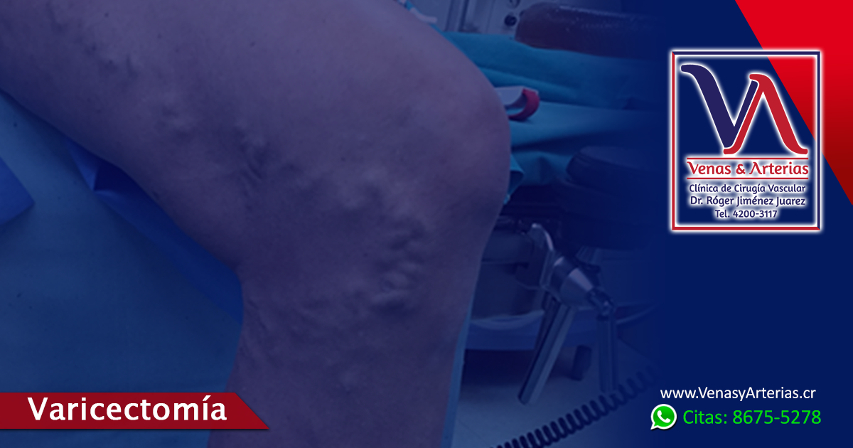 nota_FB-Ag2